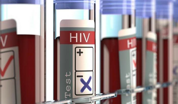 Paziente affetta da Hiv guarisce dal virus in maniera naturale: nuove speranze per il vaccino