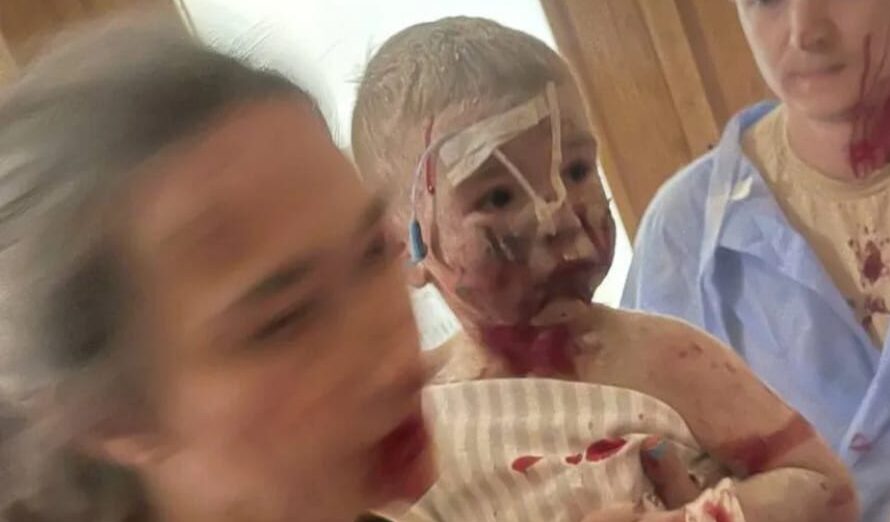 Le bombe di Putin sull'ospedale pediatrico di Kiev: "Dio è paziente ma c'è un limite a tutto"